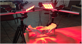 DIC-on-pelvis-bone-compression